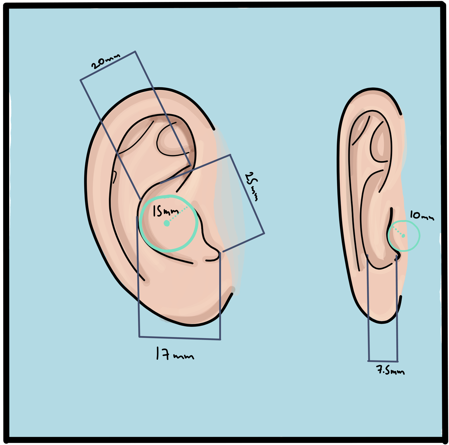 Ear sketches with measurements: 20 mm, 25 mm and 17 mm across the ear, a 15 mm circle at the ear canal, and 10 mm and 7.5 mm from the side.