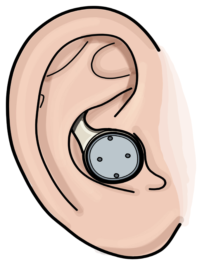 Sketch of the round earbud sitting in an ear.
